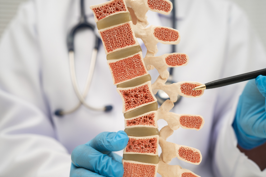 脊椎側彎怎麼發現？症狀、成因、自我檢測與診斷流程完整解析