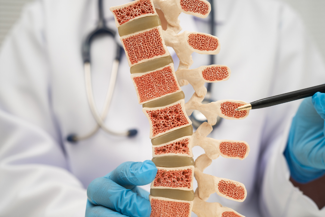 脊椎側彎怎麼發現？症狀、成因、自我檢測與診斷流程完整解析